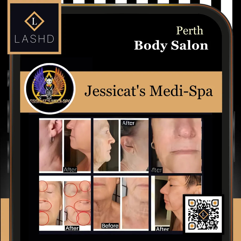 Body - Western Australia Perth - Lashd App - Jessicat's Medi-Spa